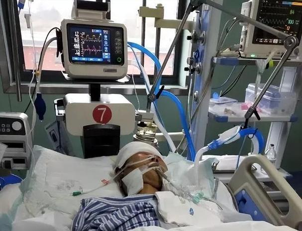 进ICU是不是死定了