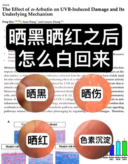 脸晒黑了最快恢复办法