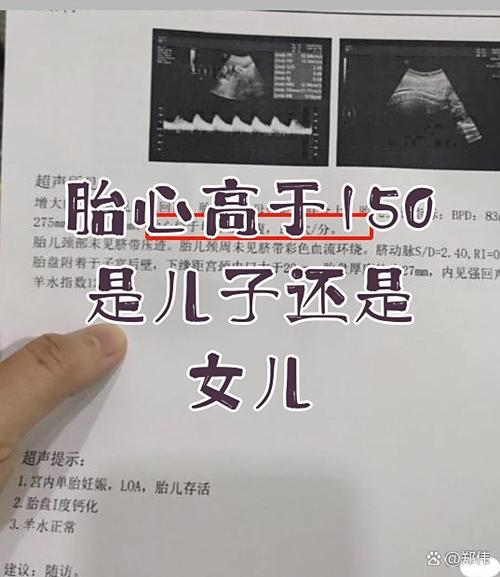 孕23周胎心145男孩女孩