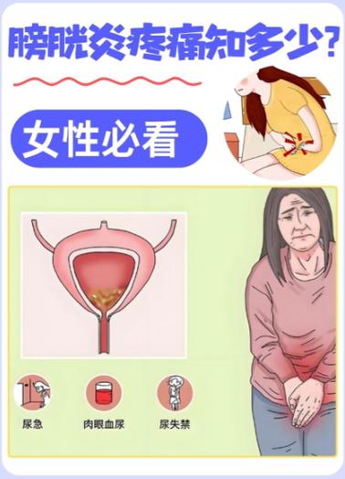 女性尿急憋不住尿裤子