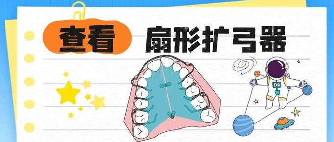 扩牙弓一般扩多少天