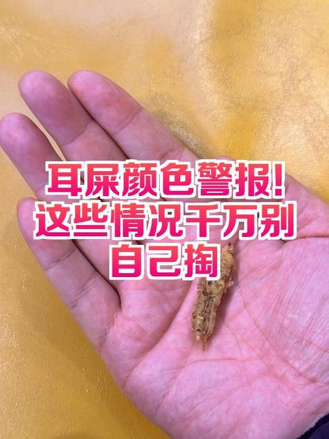 为什么戴耳麦耳屎会特别多