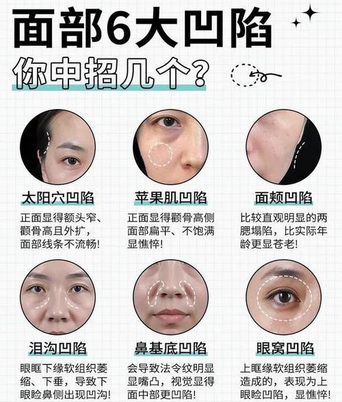 30岁脸颊凹陷是什么原因