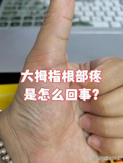 大拇指端疼的原因
