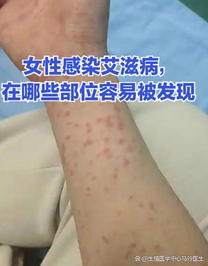 艾滋病病毒属于细菌病毒吗