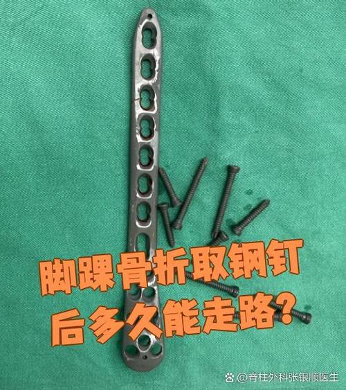 钢钉取出后多久能走路