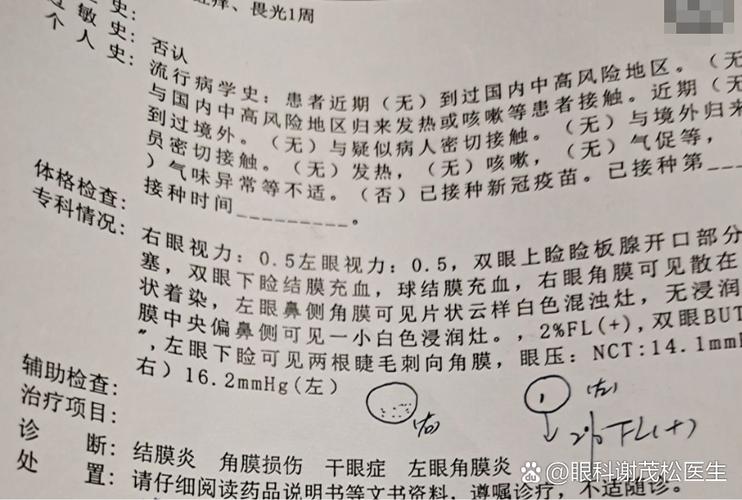 右眼视物模糊,左眼清楚