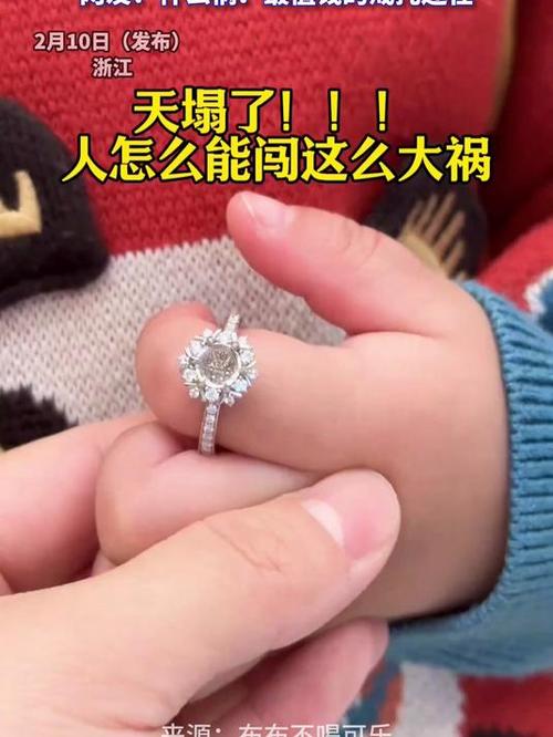 生孩子戒指去不掉怎么办
