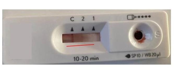 hiv假阳会一直存在吗