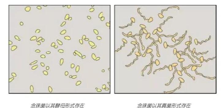 光滑念珠菌和白色念珠菌的鉴定
