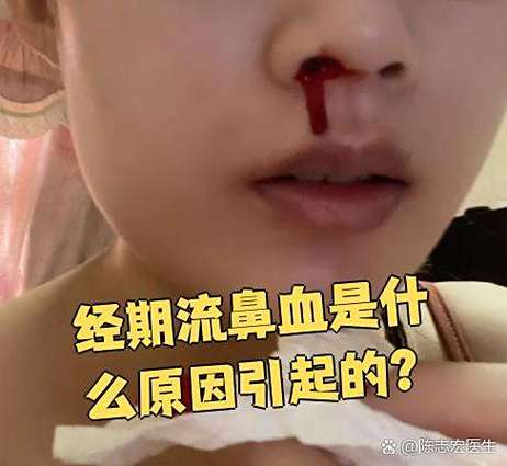 姨妈血会不会从鼻子里出来