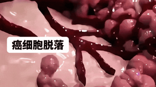 转移不除外是什么意思