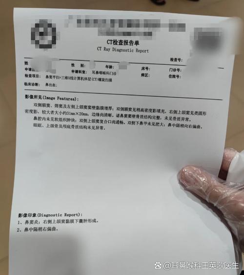 总是流鼻血是什么原因