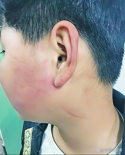 14岁打人一耳光赔偿标准截图2