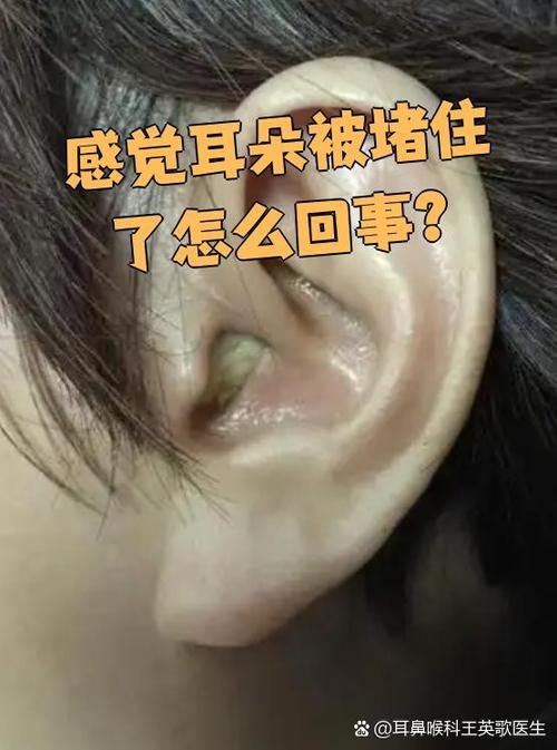 耳朵闷堵按一下通了