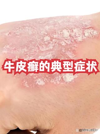 扫一扫识别皮肤病下载