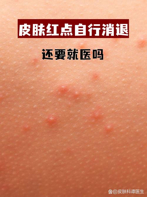 蓝莓过敏的10大表现