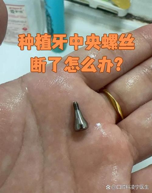 种植牙螺丝掉了图片