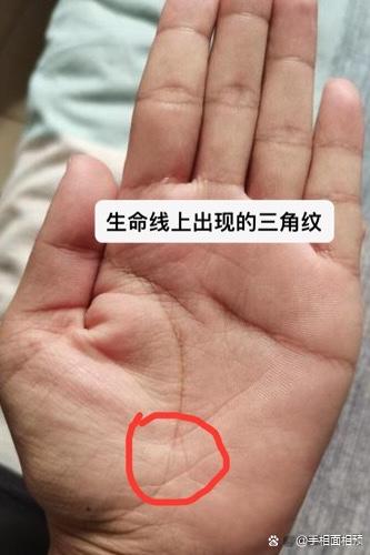 生命线尾端有三角形是什么原因