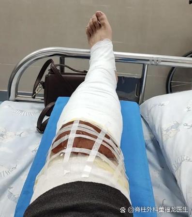 腿断了住院照片