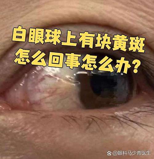 投影仪出现两块黄斑