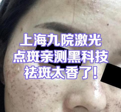 黑科技祛斑会反弹吗?截图2