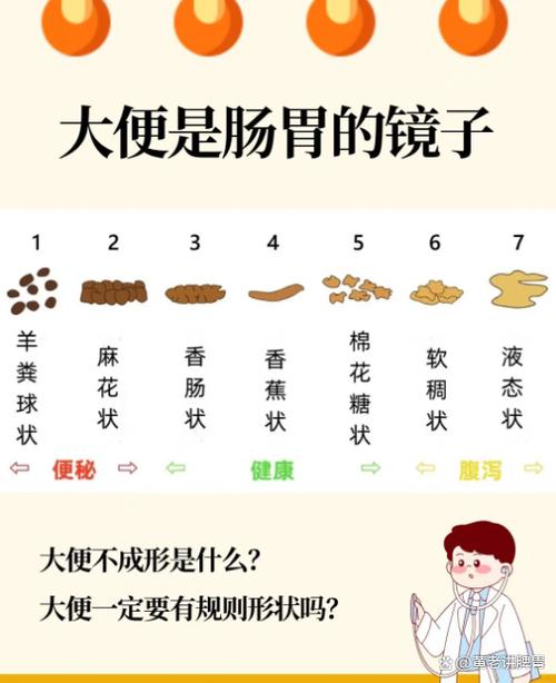 大便不通畅的原因