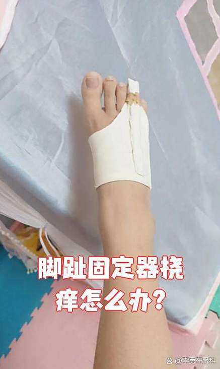 脚趾固定器挠痒专用帮起来