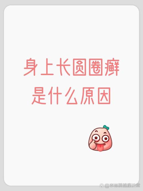 身上长圆圈是什么原因截图3
