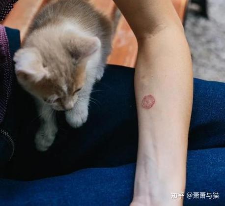 猫挠了之后全身发痒