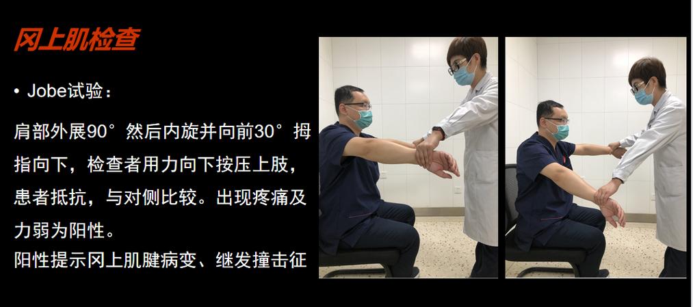 Jobe征怎么读