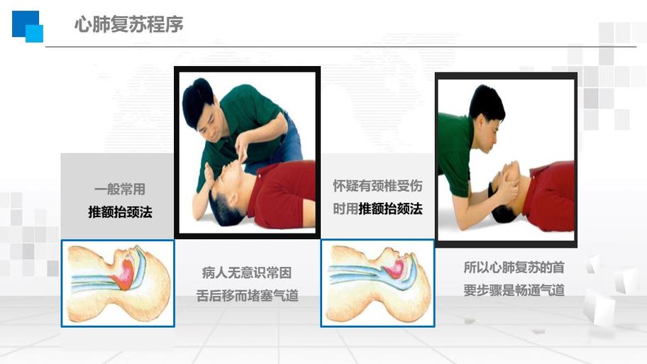 急救打开气道