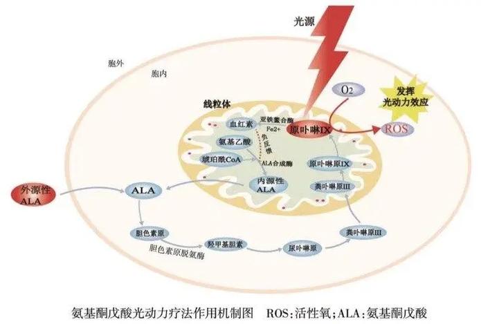 PDT治疗