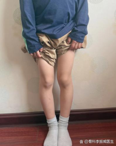 合不拢腿合集百度云