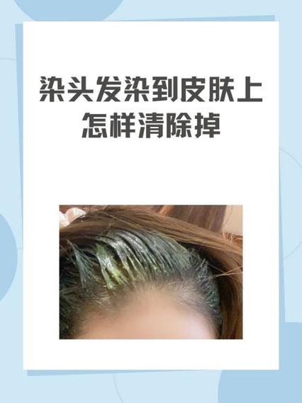 怎样清除掉落物