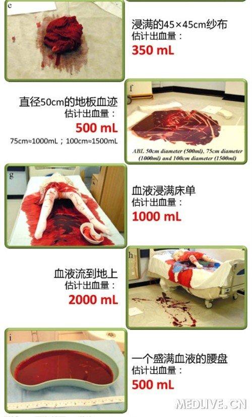 一个人的血量怎么计算截图3