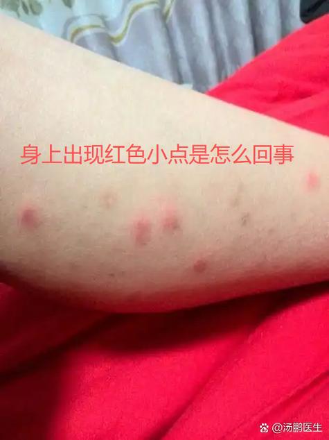 身上痒小红点截图2