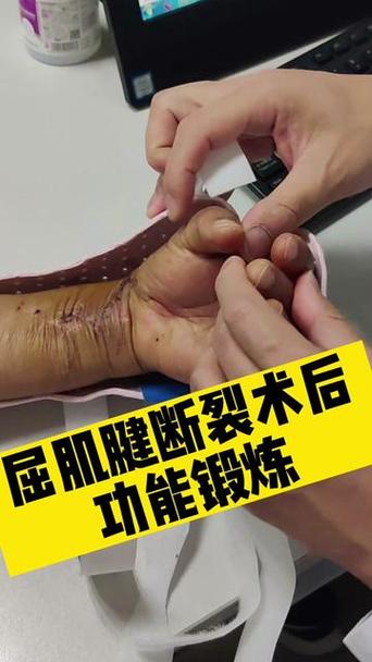 手腕肌腱恢复锻炼视频