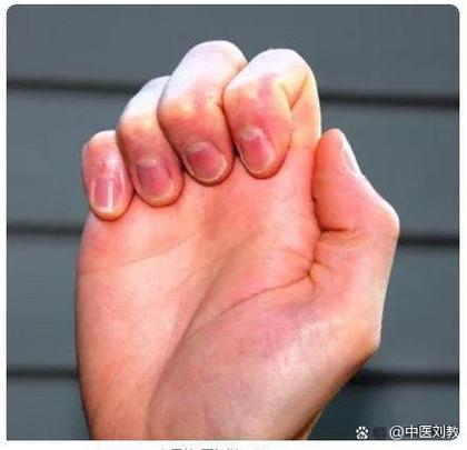手腕肌腱恢复锻炼视频截图3