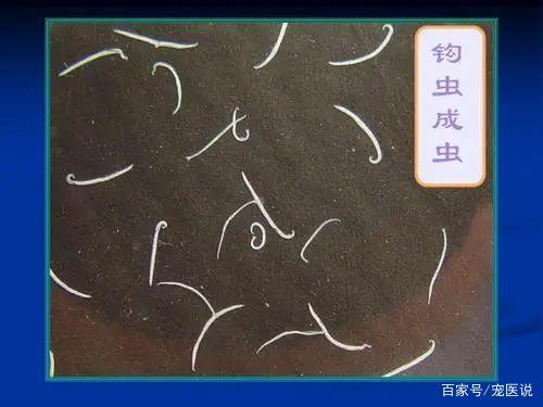 体内寄生虫版本大全