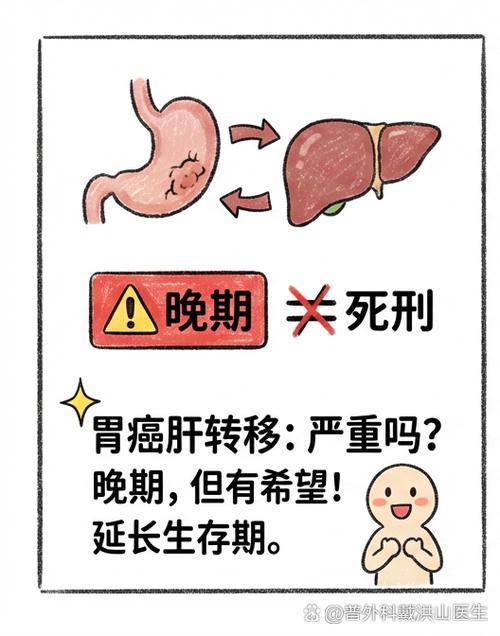 只要转移的都是晚期吗