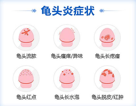 男性生殖外皮痒是什么原因