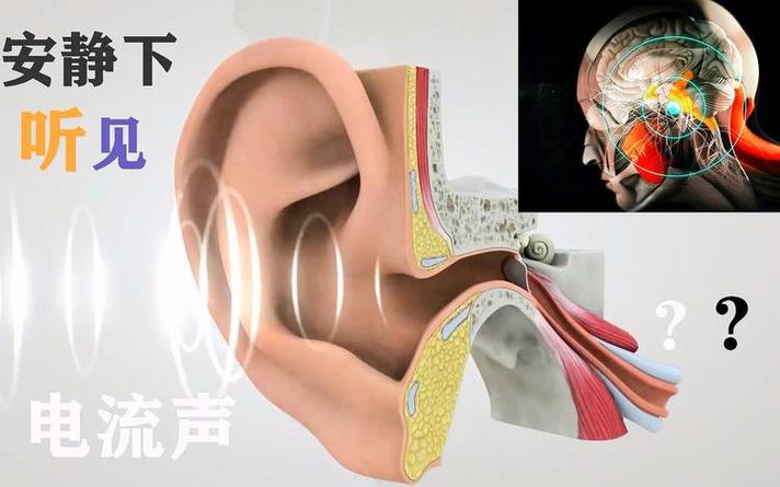 为什么听见电流的声音