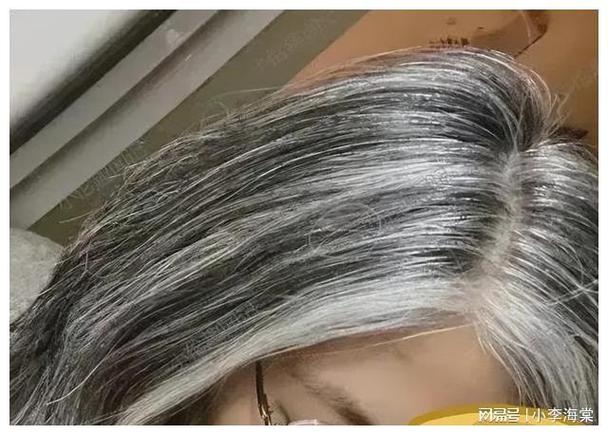 有什么办法一夜白头发
