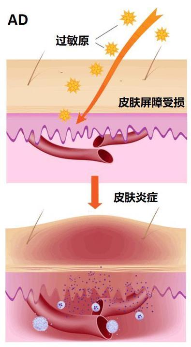 修复受损皮肤屏障的方法