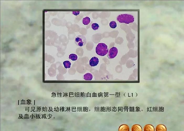 allb指什么