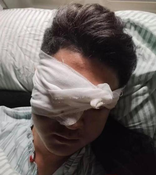 现在的oled屏幕还伤眼吗