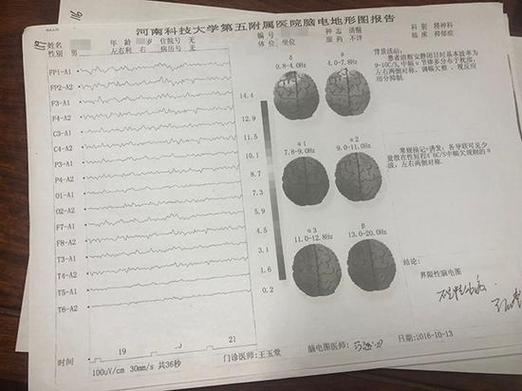 脑地形图能检查出精神病吗