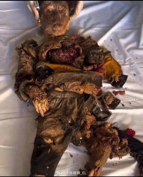 人死亡的过程 人死亡的过程