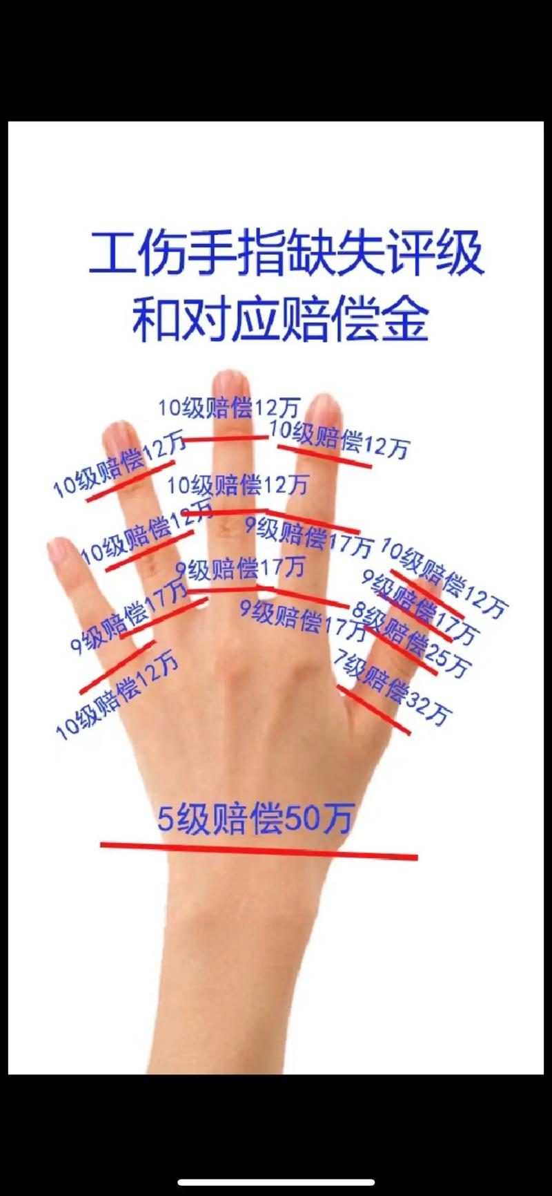 手指工伤赔偿截图1